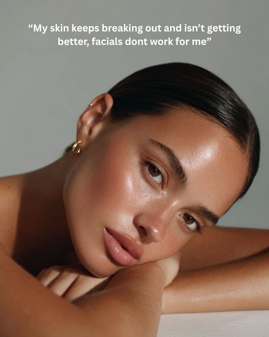 Skin by Skylar
